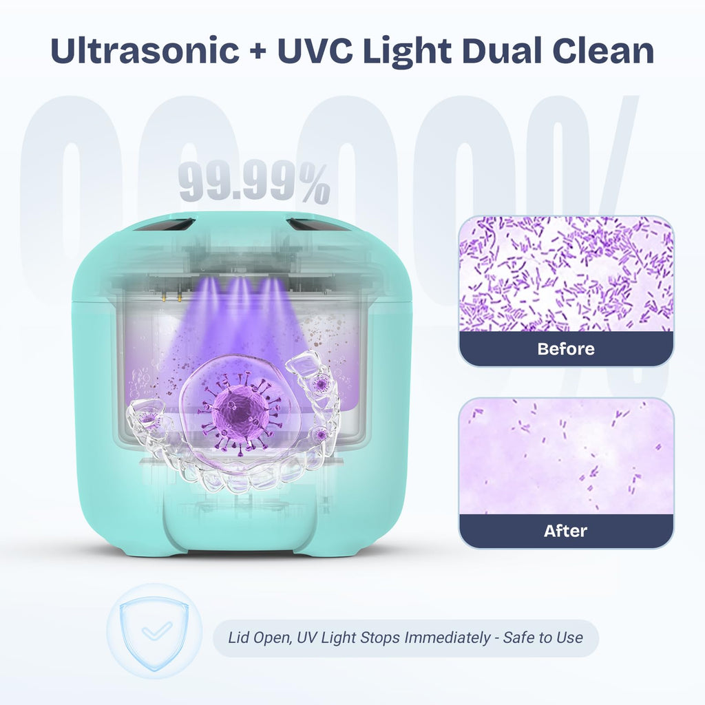 2025 Ultrasonic Retainer Cleaner 45kHz 25W – Portable with Drying (Blue)