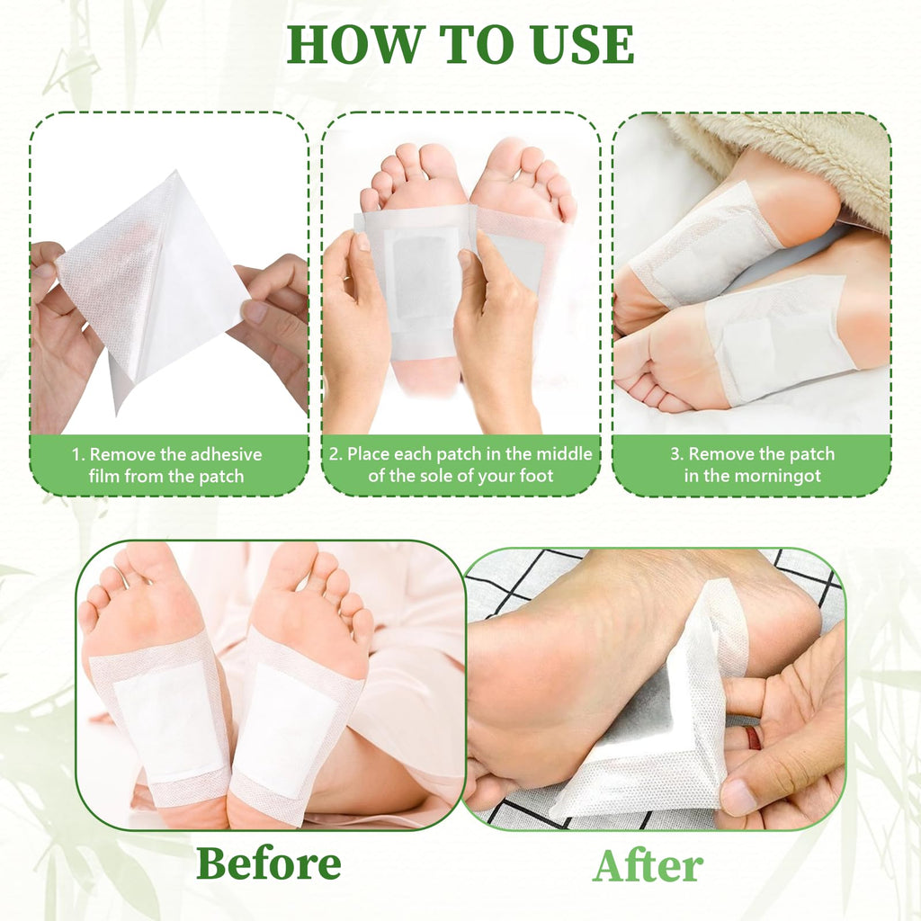30PCS Bamboo Ginger Foot Pads – Deep Cleansing & Relaxation