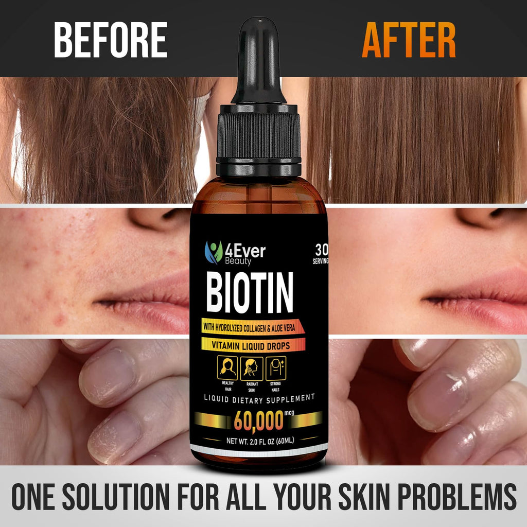 4Ever Beauty Biotin & Collagen Drops with Aloe – 60,000 mcg B7, Hair Growth, Nails, Skin – 2 fl oz