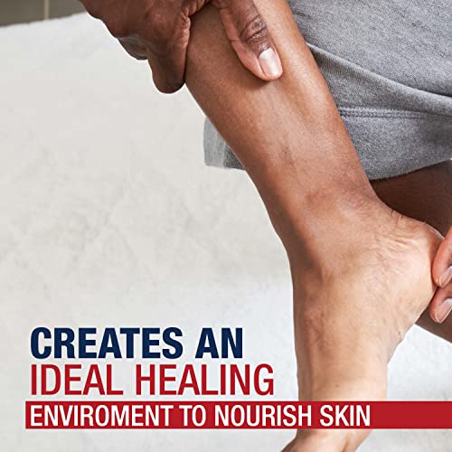 Aquaphor Healing Ointment: Advanced Therapy Skin Protectant, 14 oz Jar (Pack of 12)
