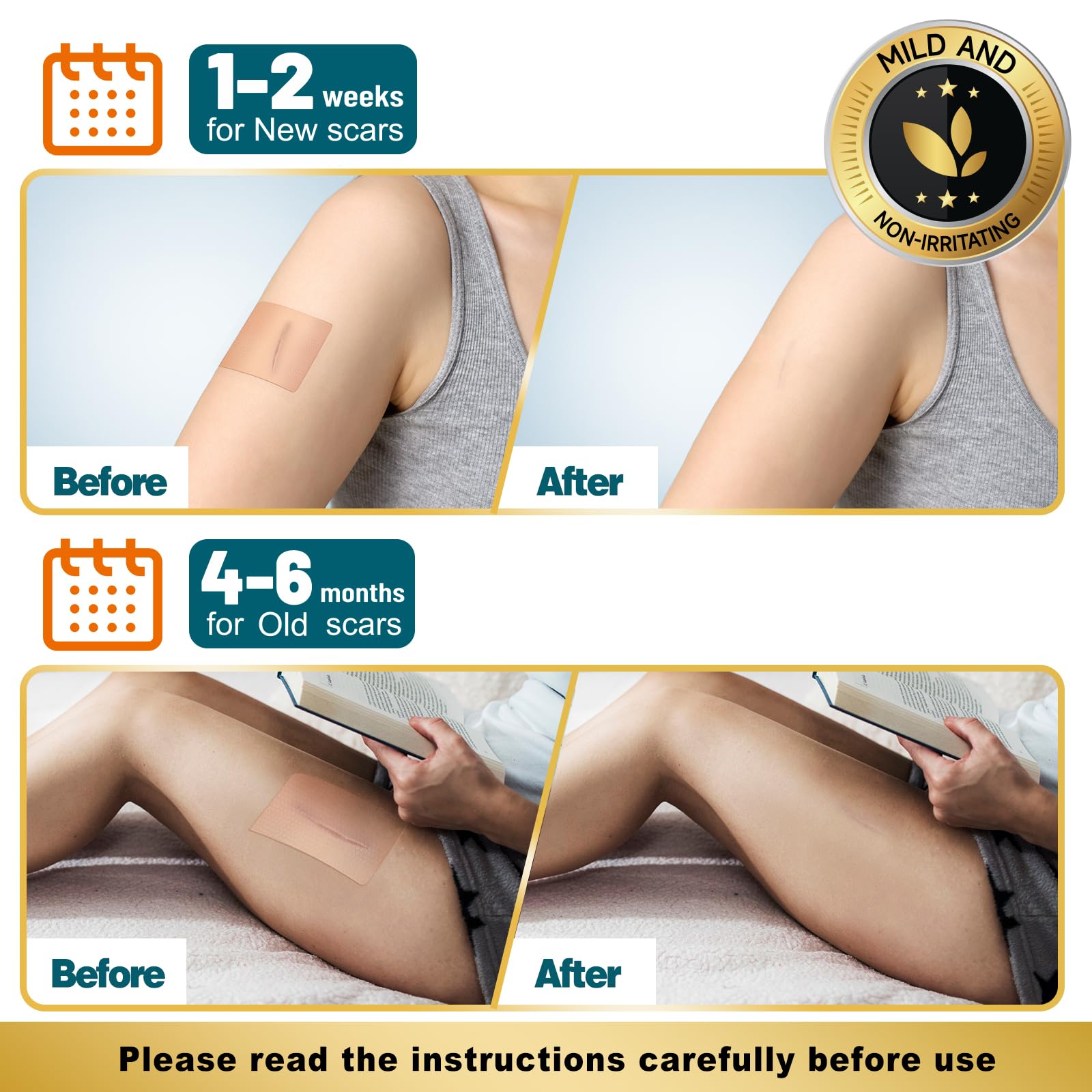 Arme Silicone Scar Tape Roll (1.6x180) – Medical-Grade Scar Sheets for Surgical Scars