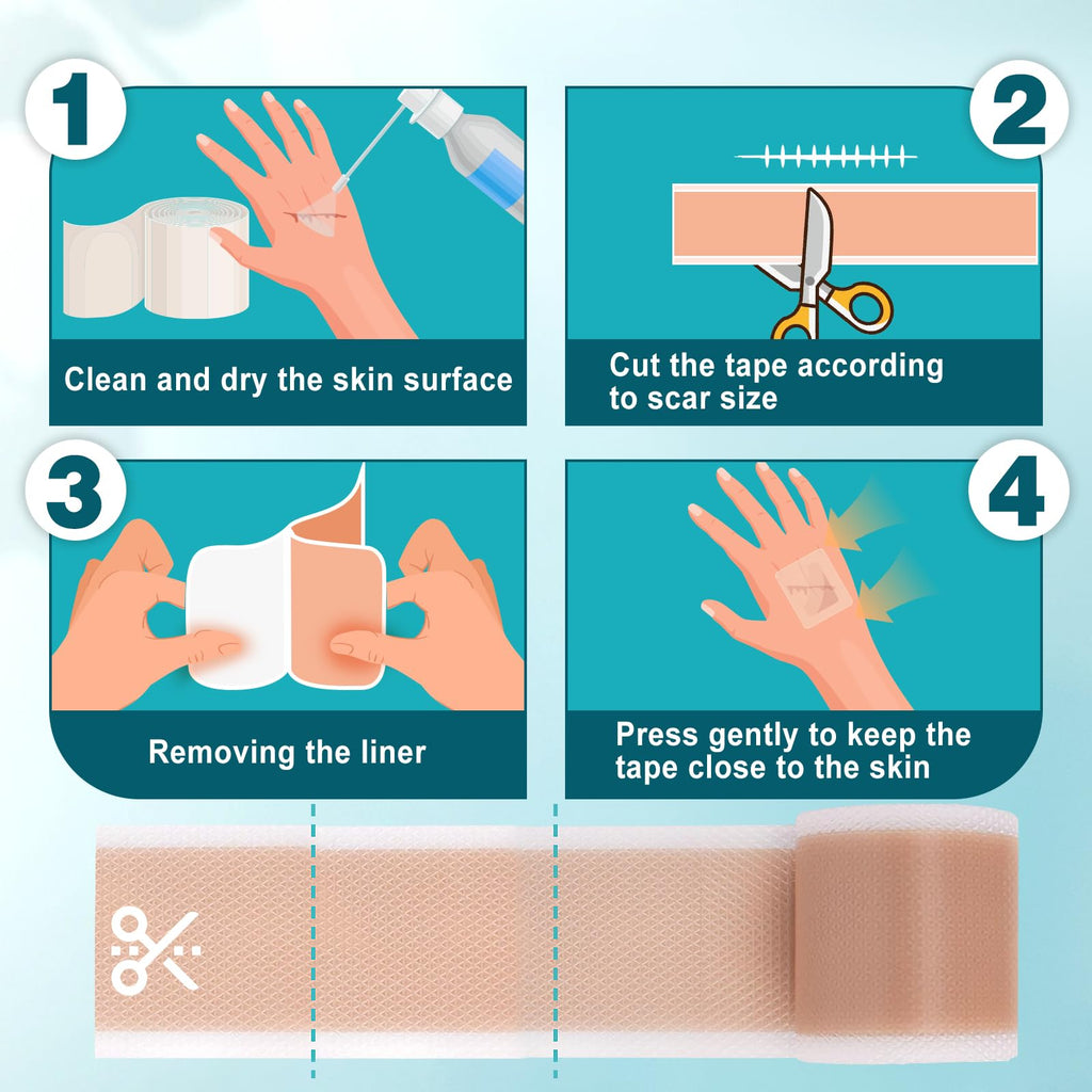 Arme Silicone Scar Tape – 1.6in x 240in Medical-Grade Scar Sheets (2 Rolls)