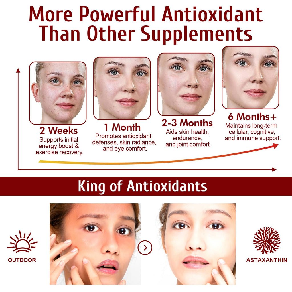 Astaxanthin 12mg – 120 Softgels (4 Month Supply) Premium Antioxidant Support