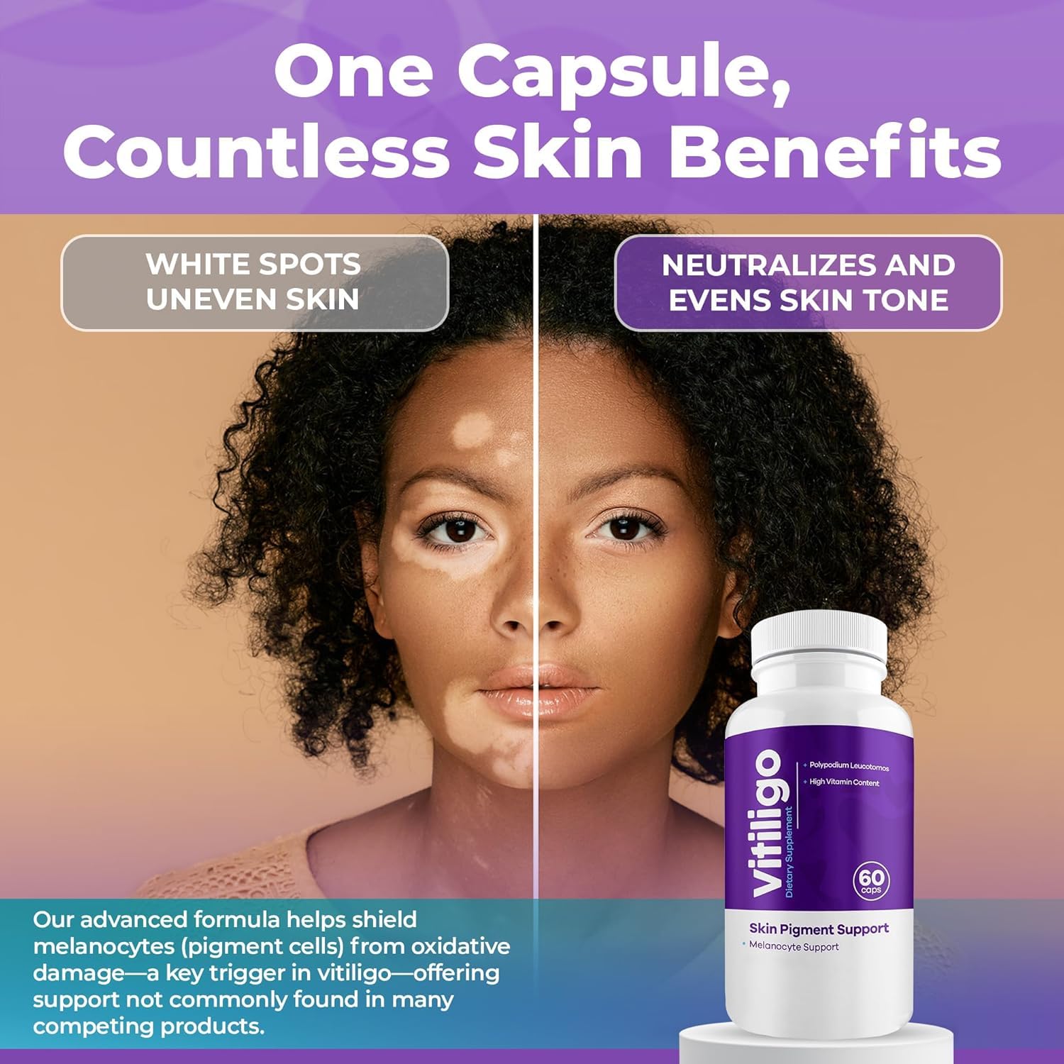 AURA VITAMINS Vitiligo Capsules – 60 Count | 1 Month Supply for Skin Pigmentation Support
