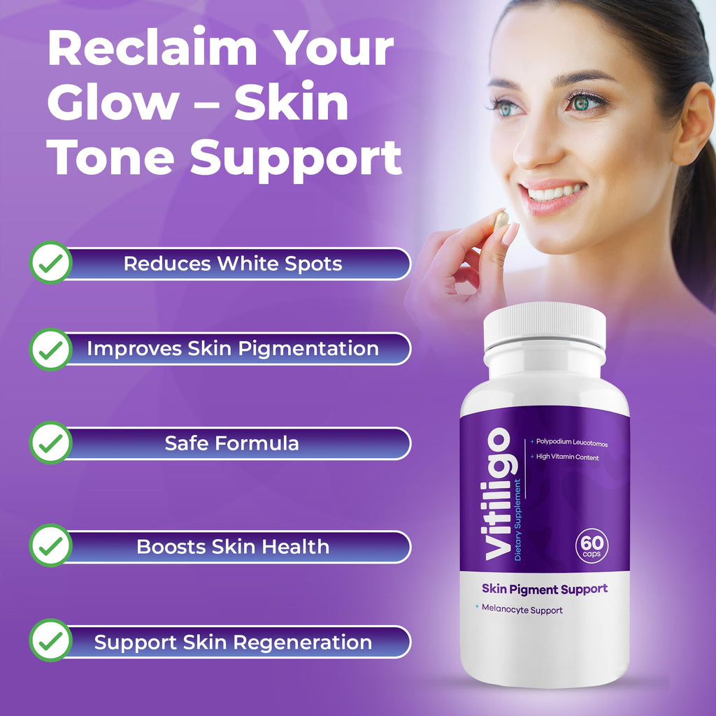 Aura Vitamins Vitiligo Capsules 60 Count | Support Skin Pigmentation & Reduce White Spots