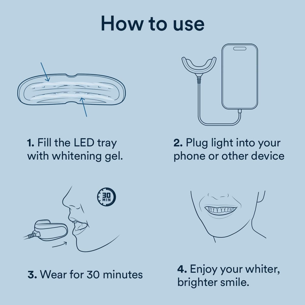Auraglow Teeth Whitening Kit – Wired LED Accelerator Light, 35% Carbamide Peroxide, 12 Treatments, Whitens Up to 10 Shades in 7 Days