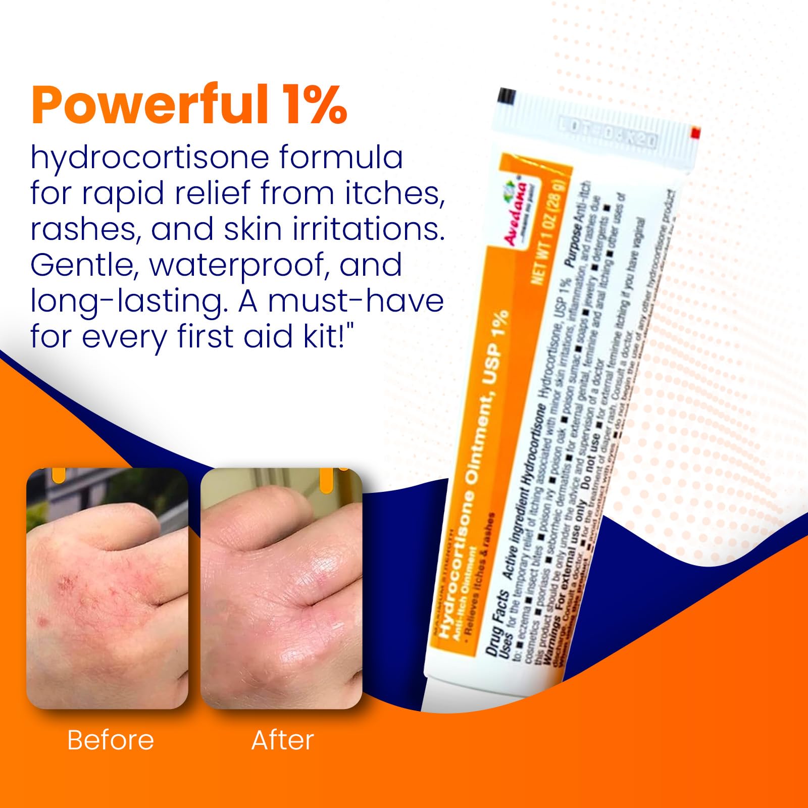 AVEDANA Hydrocortisone Ointment 1% – Maximum Strength, Waterproof Anti-Itch Relief