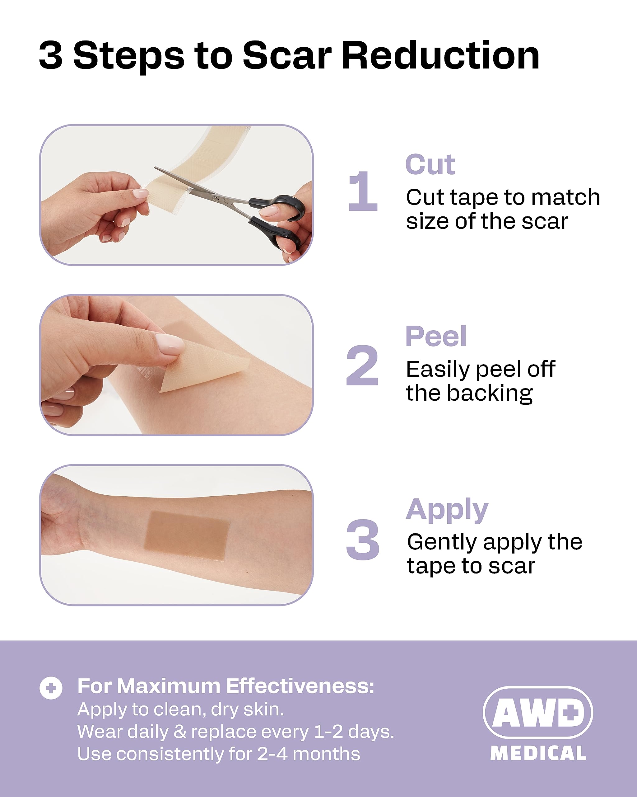 AWD Silicone Scar Tape Roll 60in – Medical-Grade Scar Tape for Surgical Scars, C-Section, Tummy Tuck, Reusable Scar Sheets
