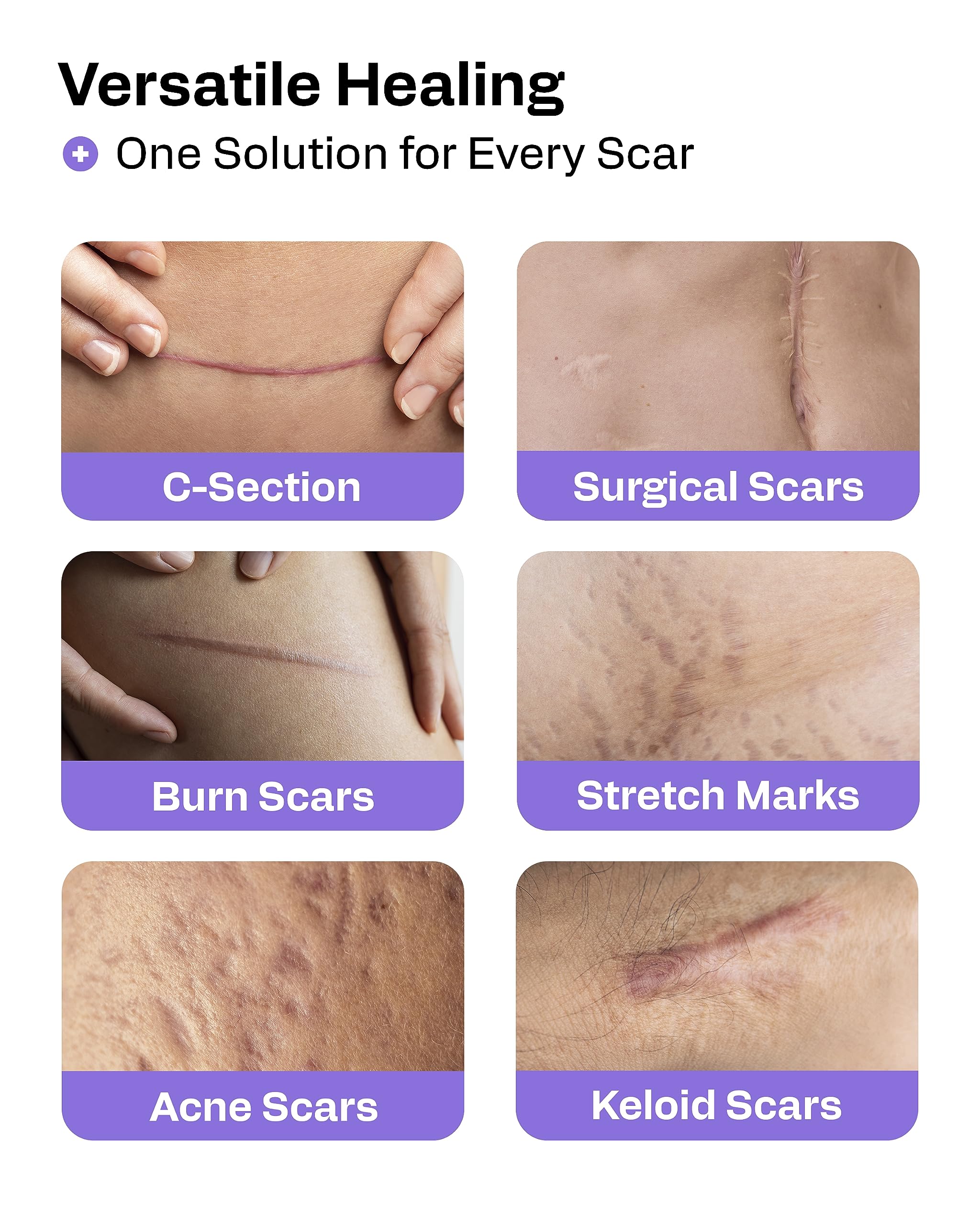 AWD Medical Silicone Scar Tape 120in Roll – Medical Grade Scar Sheets for Surgical, C-Section & Postpartum Recovery