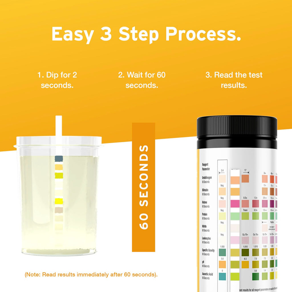 AYDMED 9-in-1 UTI Test Strips – 100 Count | 9 Parameters | FSA & HSA Eligible