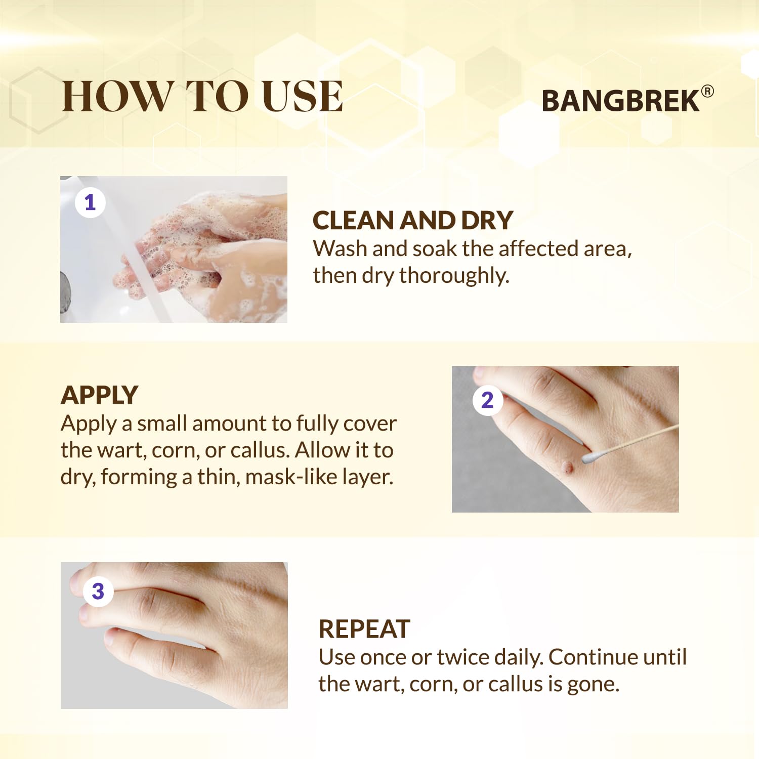 Bangbrek Bee Venom Wart Remover — 17% Salicylic Acid Fast-Acting Wart & Callus Remover (1 fl oz)