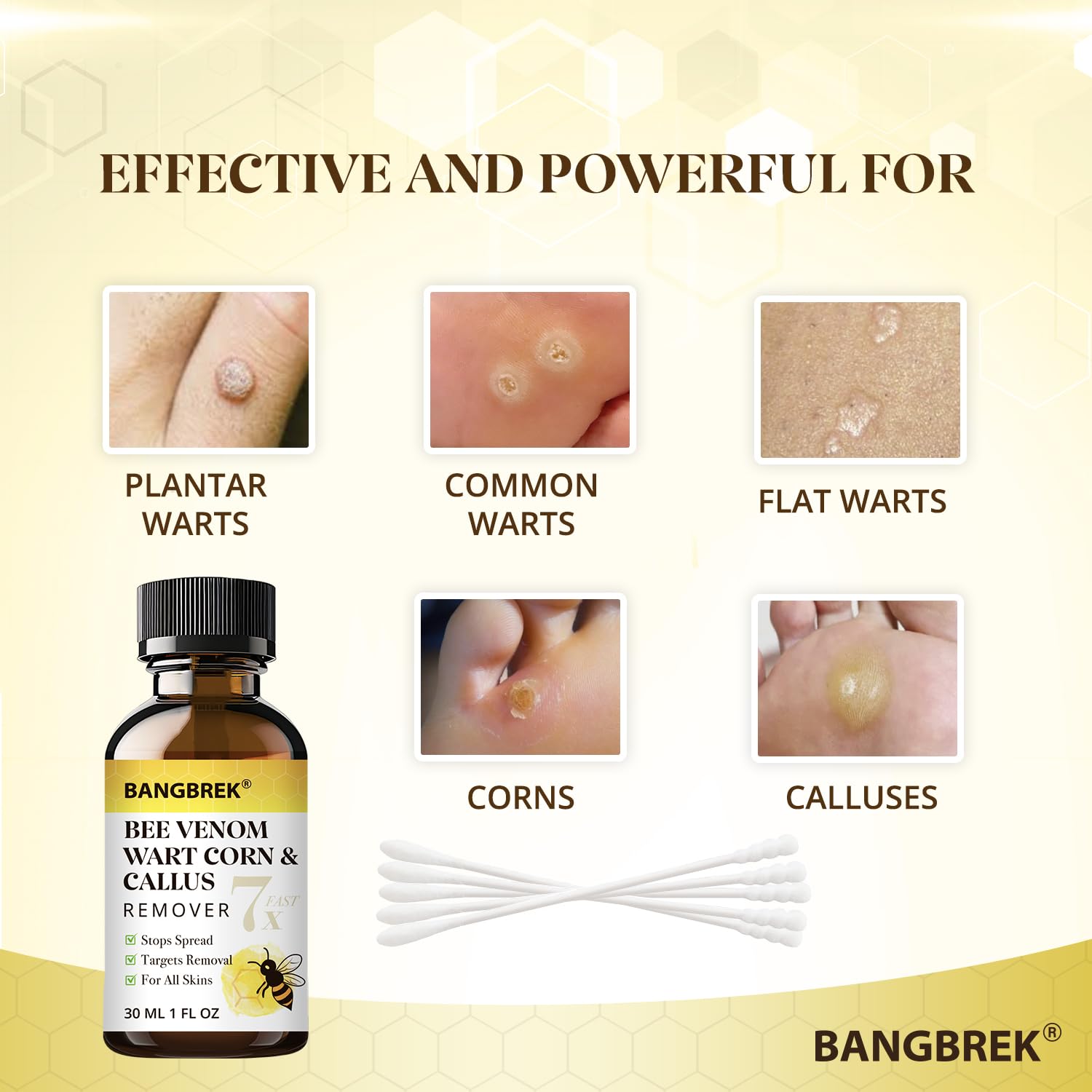 Bangbrek Bee Venom Wart Remover — 17% Salicylic Acid Fast-Acting Wart & Callus Remover (1 fl oz)