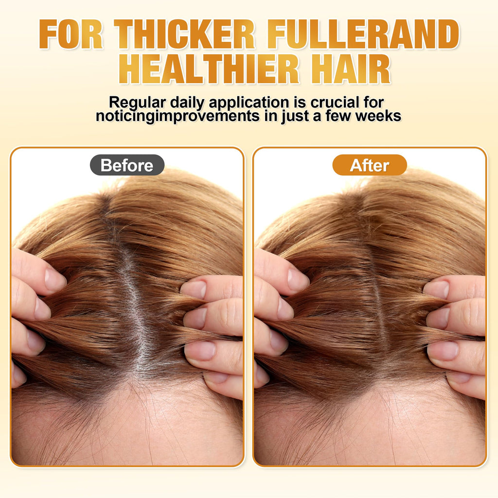 Raw Batana Oil For Hair Growth – 100% Natural Organic Batana Oil, Unrefined & Non-Greasy