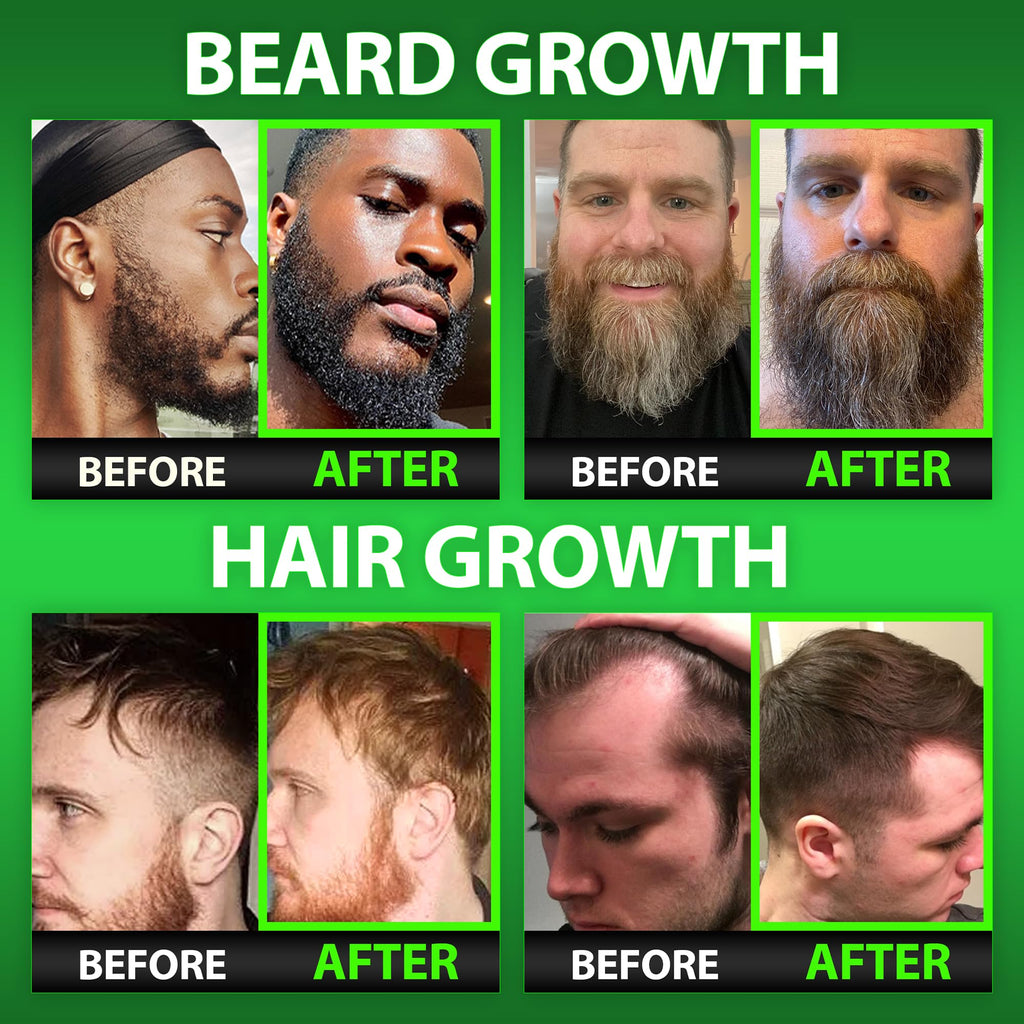BBS Best Beard Stuff – Maximum Strength Biotin Gummies for Beard & Hair Growth