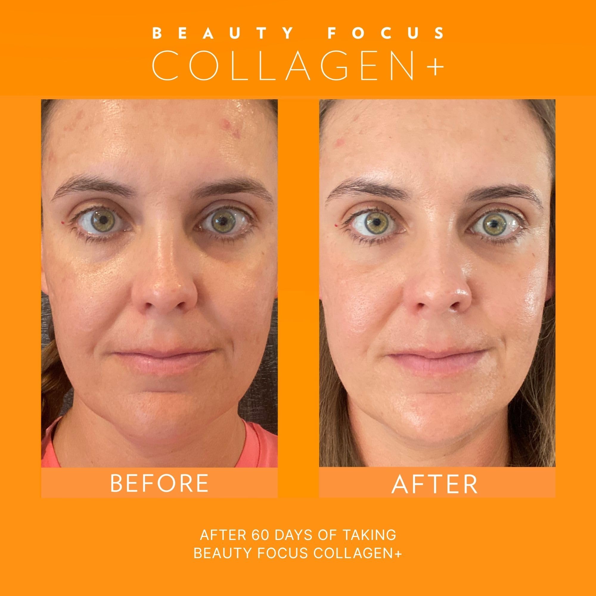 Beauty Focus Collagen Plus – Peach Flavor | 1.0 oz, 30 Packets | Skin Hydration & Hair Support