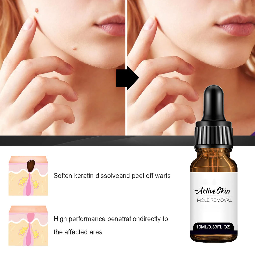 Befada Skin Mole Remover for Face & Body – Precision Dropper Serum, Fast-Acting Wart & Mole Care (10ML)