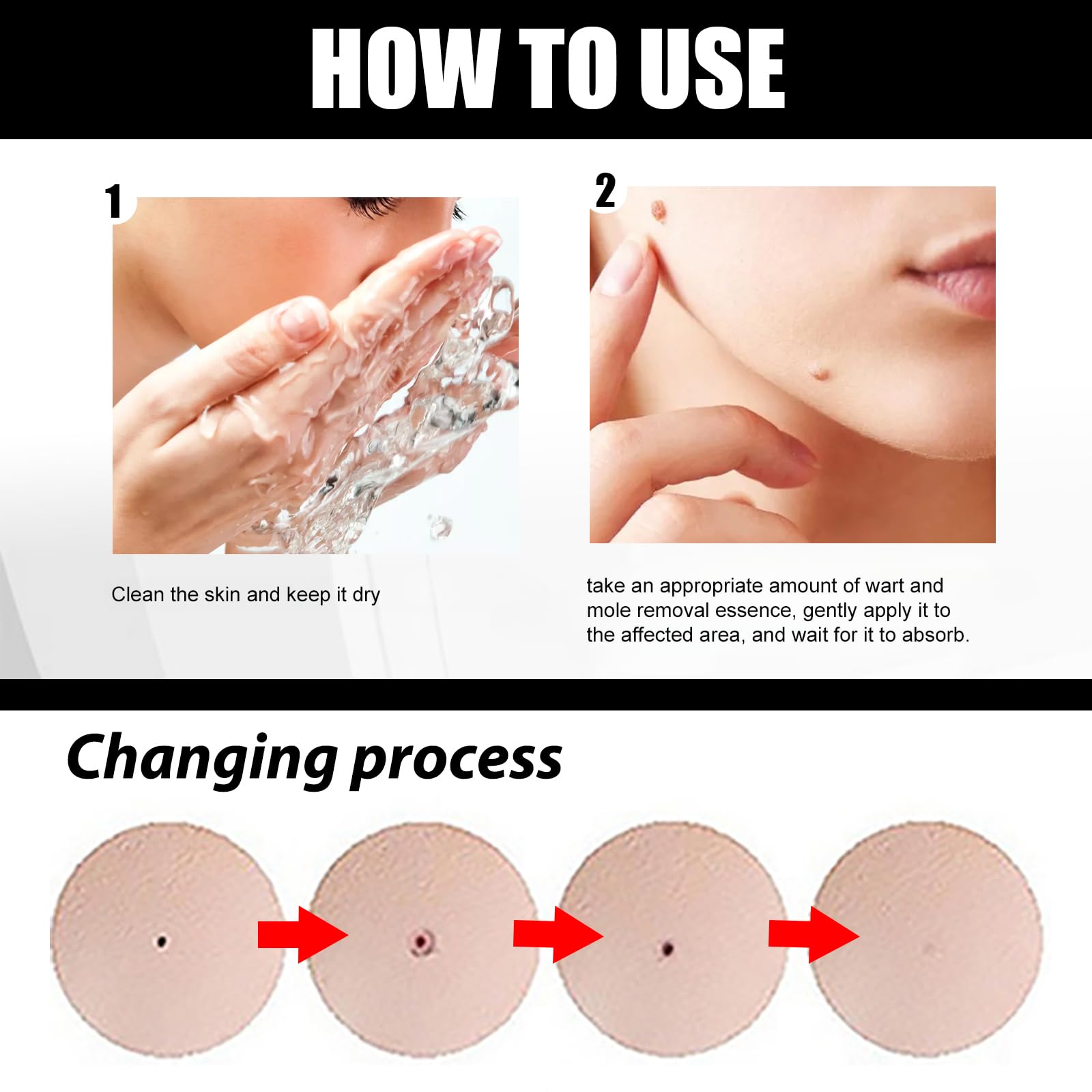 Befada Skin Mole Remover for Face & Body – Precision Dropper Serum, Fast-Acting Wart & Mole Care (10ML)