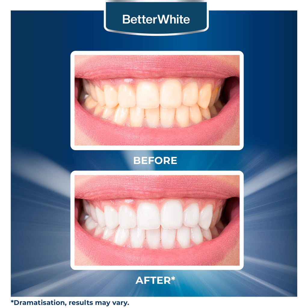 BetterWhite Teeth Whitening Powder – Hydroxyapatite, Remineralizing, Fluoride-Free (30g)
