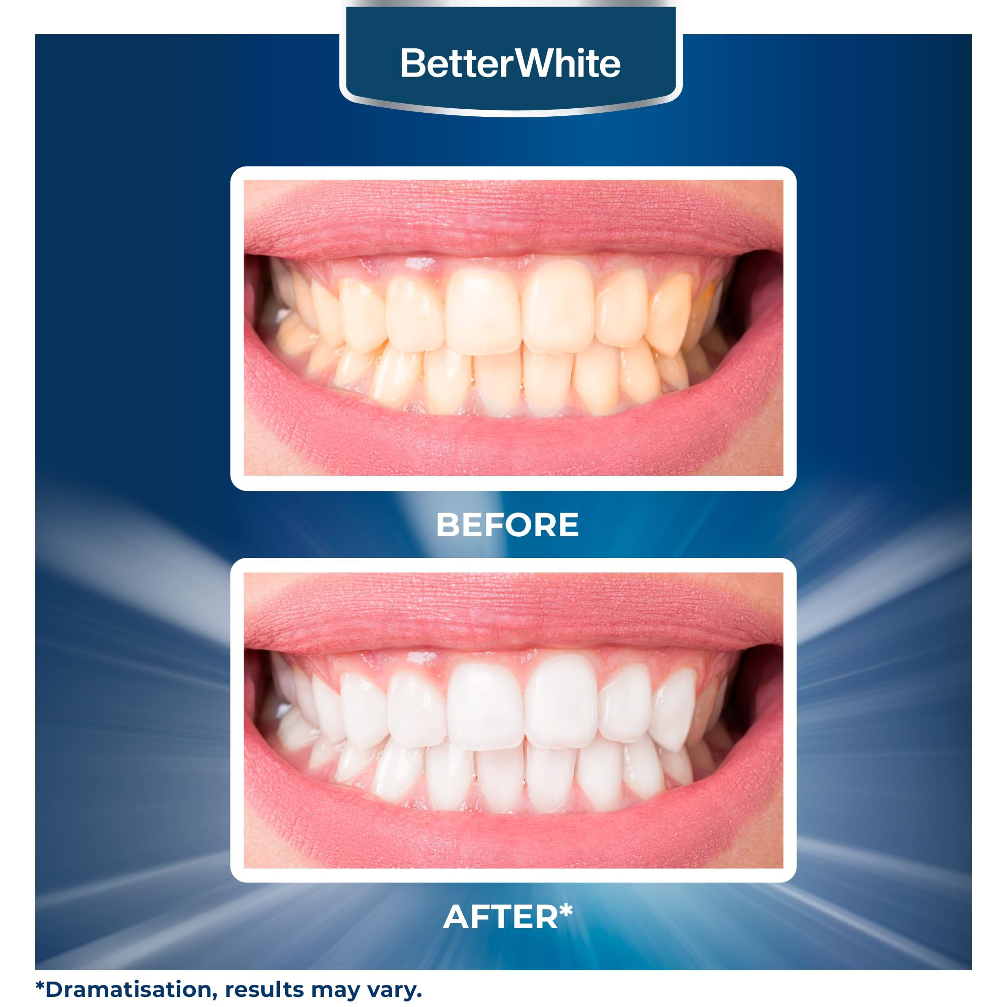 BetterWhite Teeth Whitening Powder – Hydroxyapatite, Remineralizing, Fluoride-Free (30g)