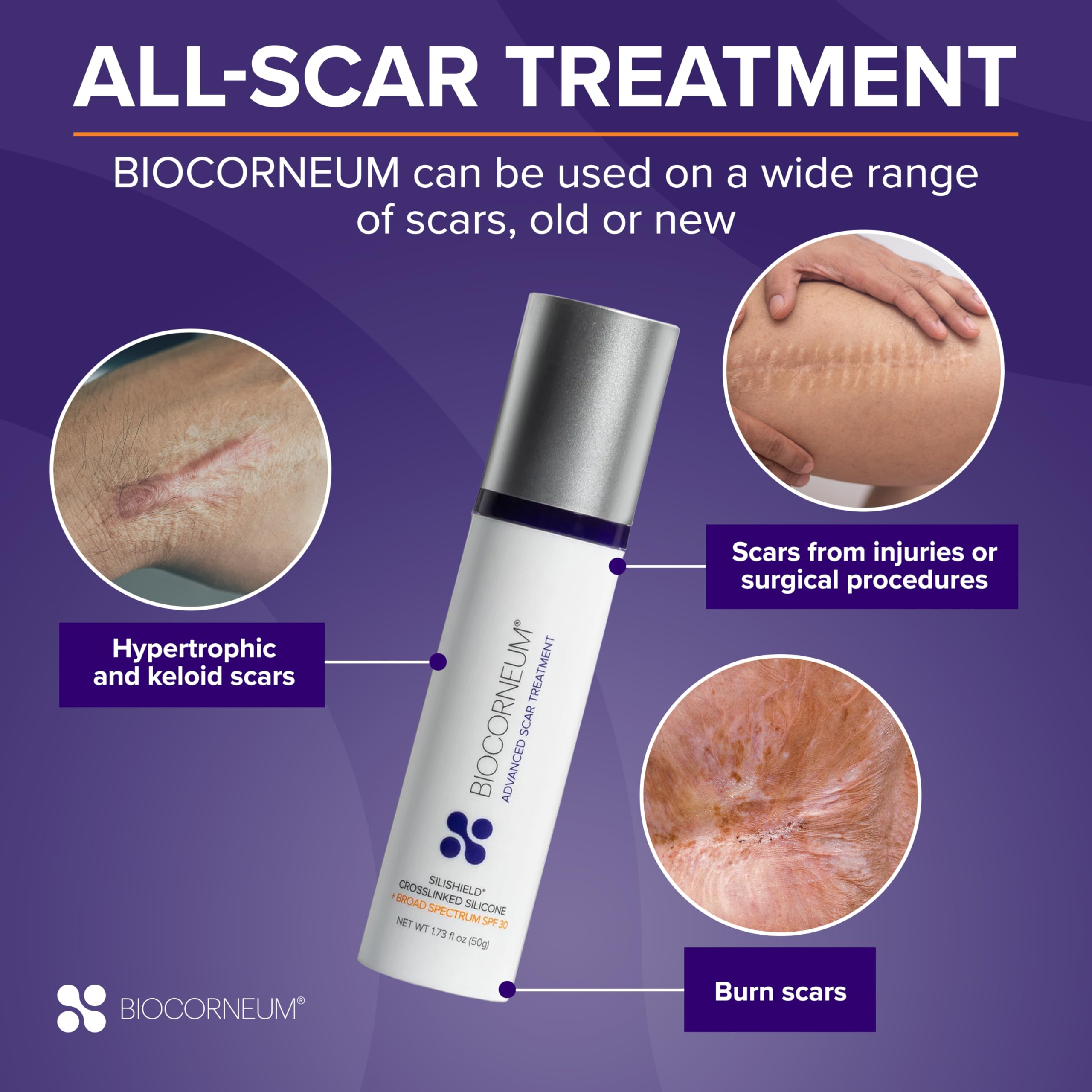 Biocorneum Advanced Scar Treatment with Silishield and SPF 30 (50g) – Silicone Scar Gel for Surgical & Old Scars