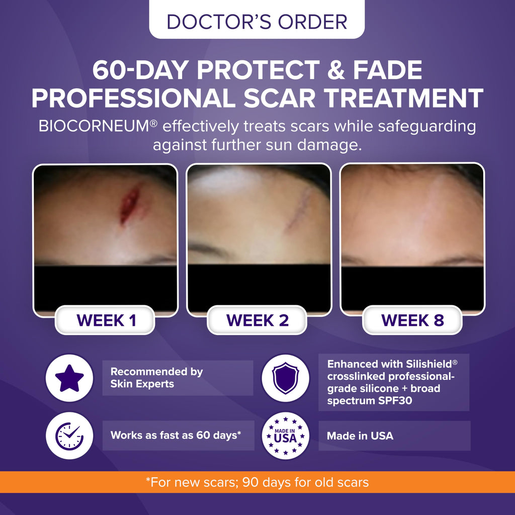 Biocorneum Advanced Scar Treatment with Silishield and SPF 30 (50g) – Silicone Scar Gel for Surgical & Old Scars