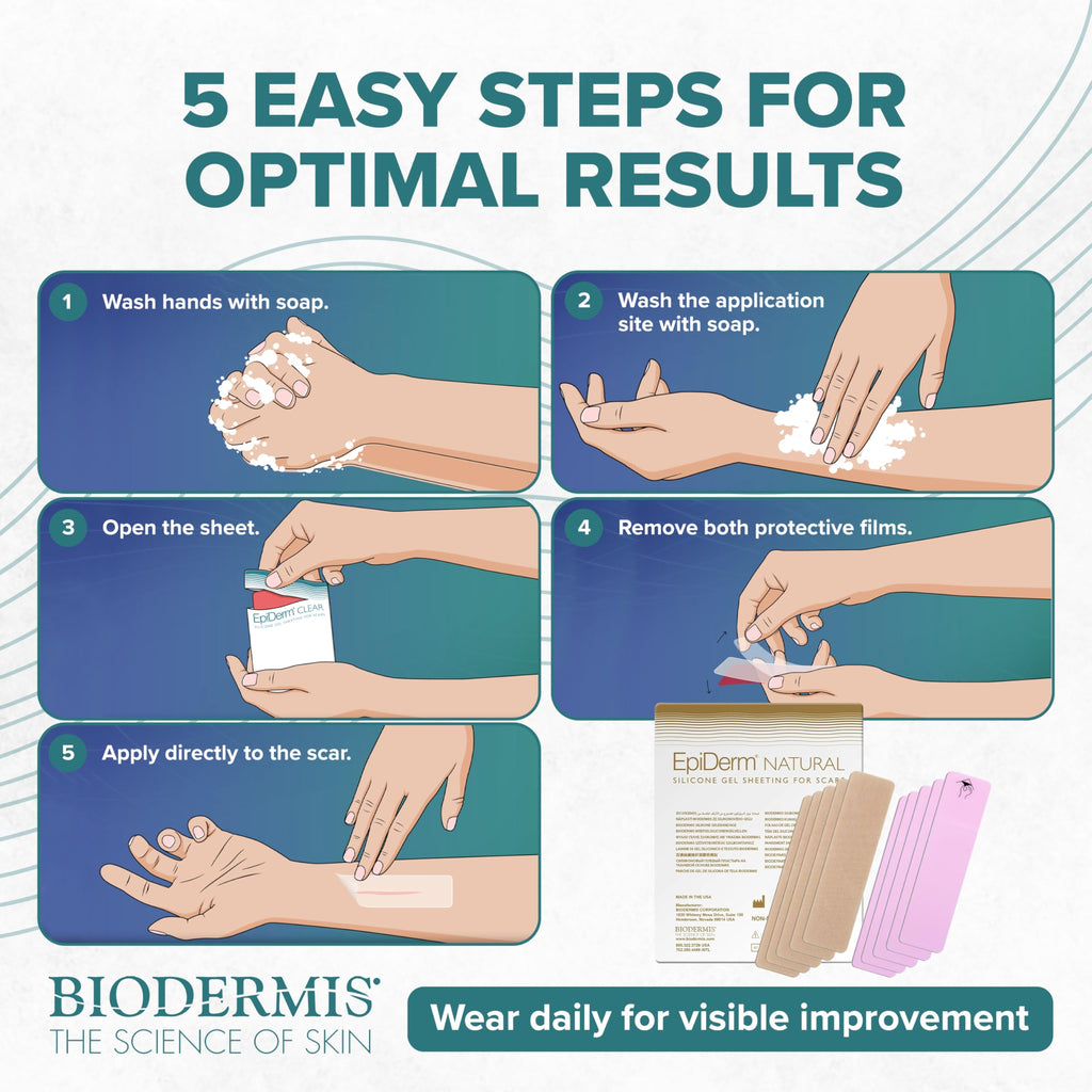 Biodermis EpiDerm Silicone Gel Scar Sheets - Premium 5-Pack, 1.4x6in, Natural