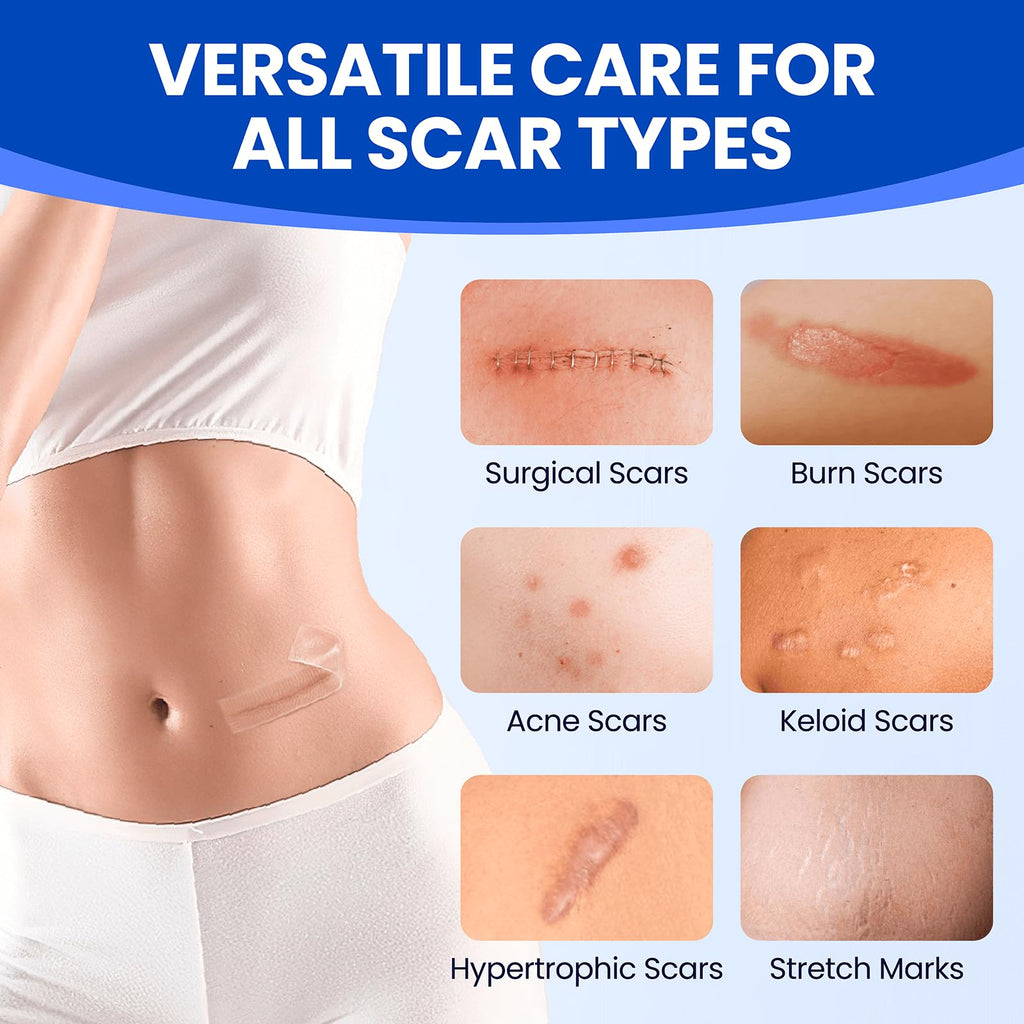Bioemmalab Silicone Scar Sheets – Surgical Tape (1.6”x120” Roll) for Face & Post-Surgery