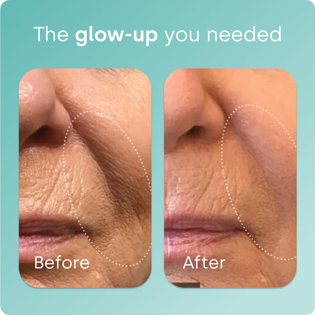 Biosil Collagen Booster Drops - Patented ch-OSA Activator for Skin, Hair, Nails & Joints (1 fl oz x 2)