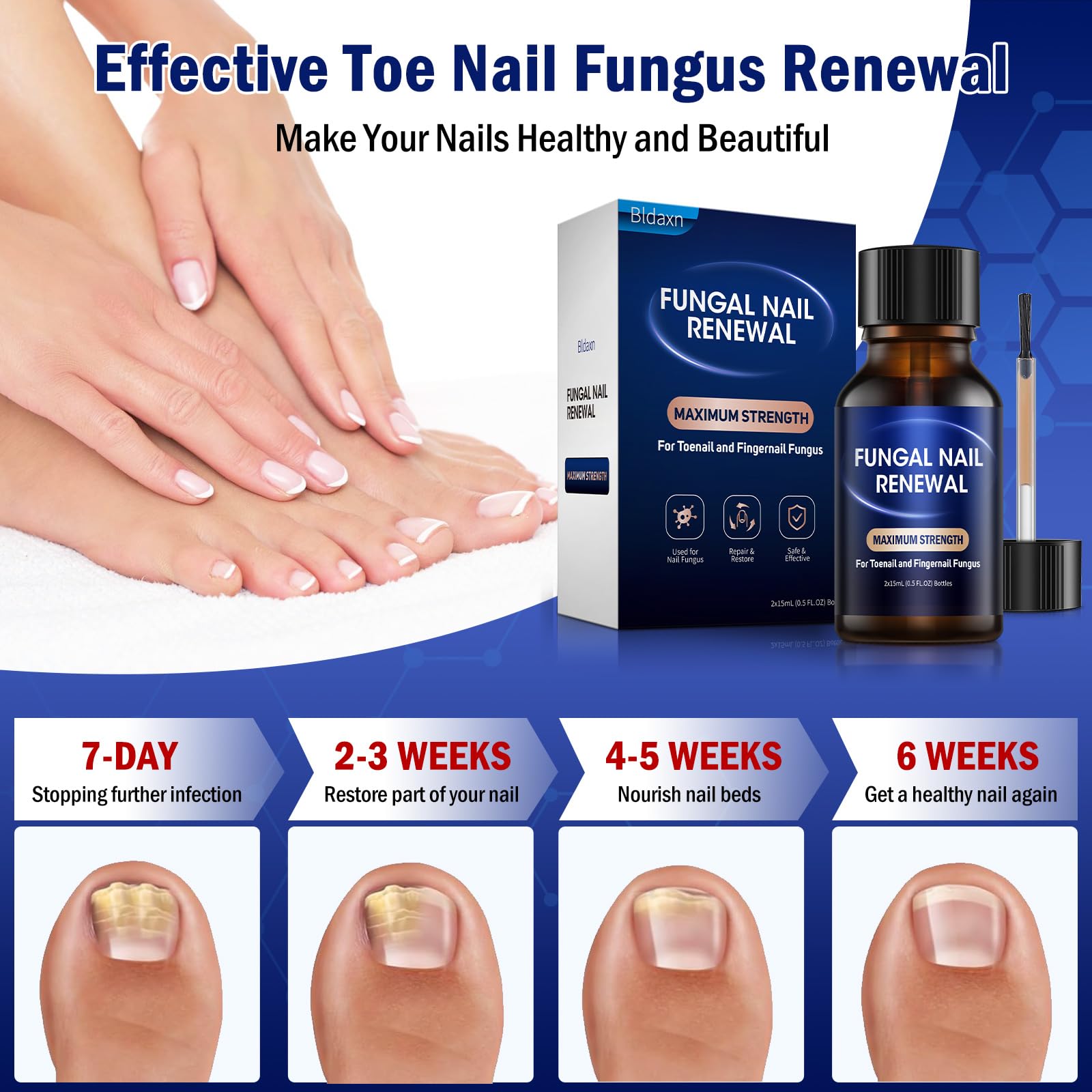 Bldaxn Toe Nail Fungus Renewal – Fast Acting 1 Pack for Thick, Discolored Nails