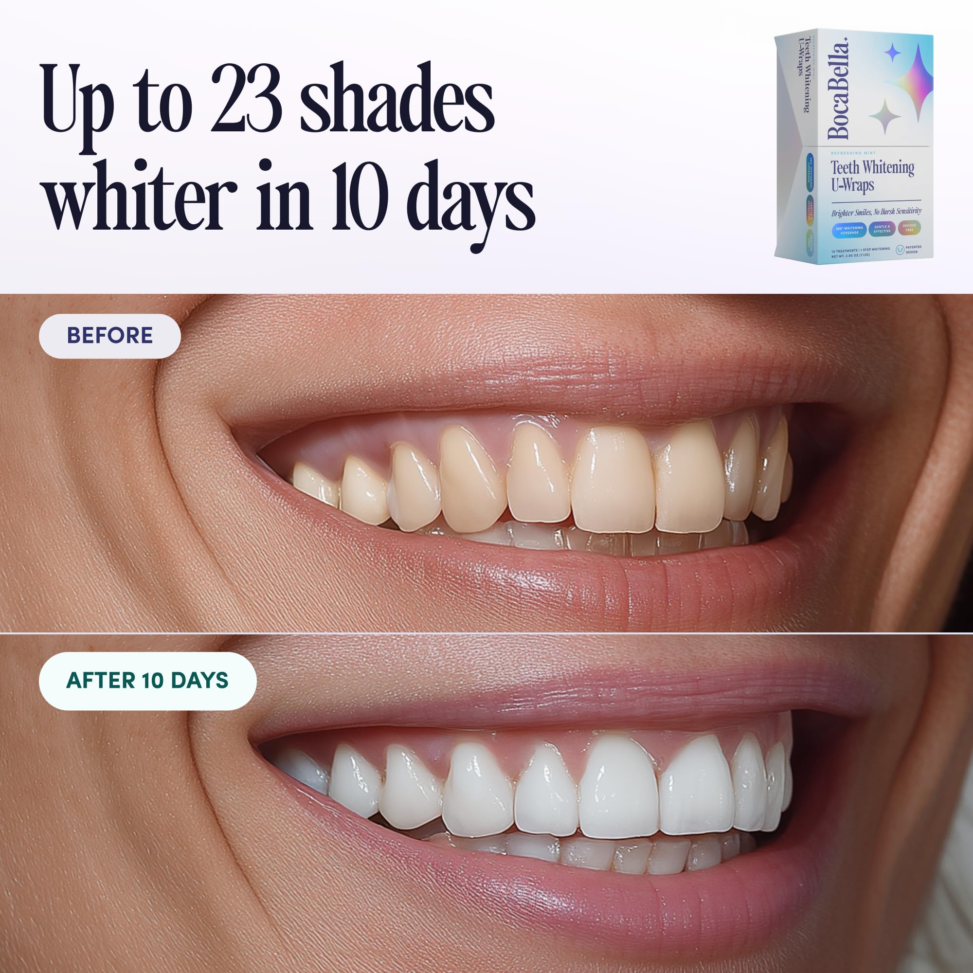Boca Bella Teeth Whitening U-Wraps – 10 Treatments, 15% Hydrogen Peroxide, Enamel-Safe