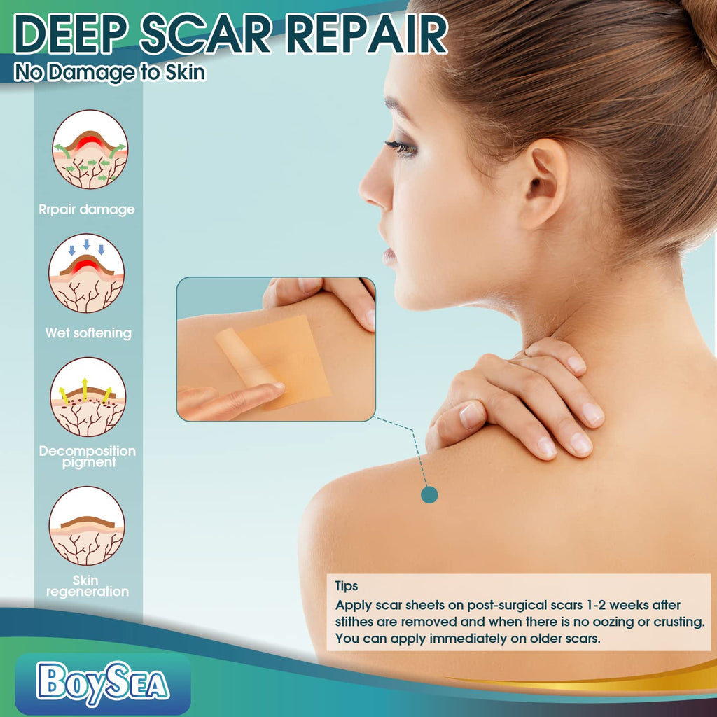 Boysea Professional Silicone Scar Sheets Roll 1.6x150 in | Reusable Scar Tape for Keloid, C-Section, Surgery, Burn & Acne