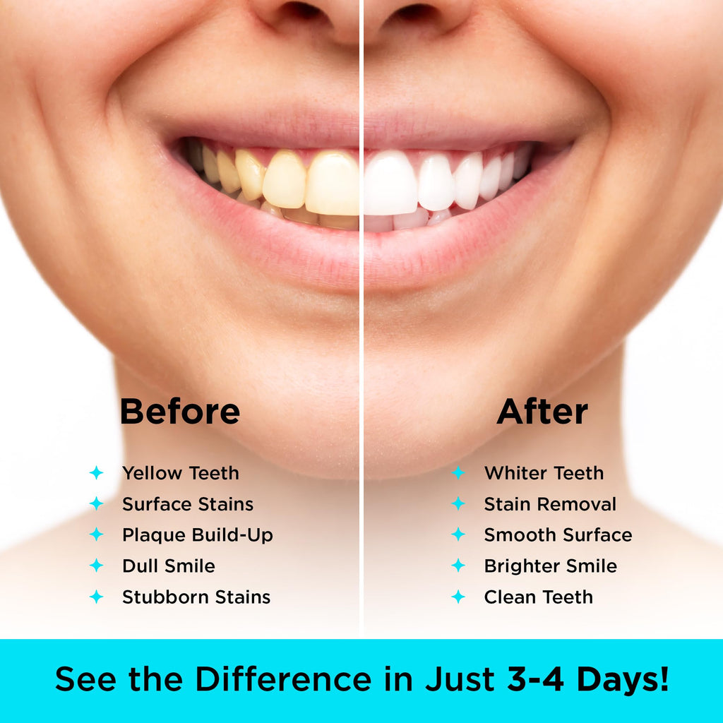 CARBON WHITE Teeth Whitening Powder - Natural Coconut Charcoal 30g