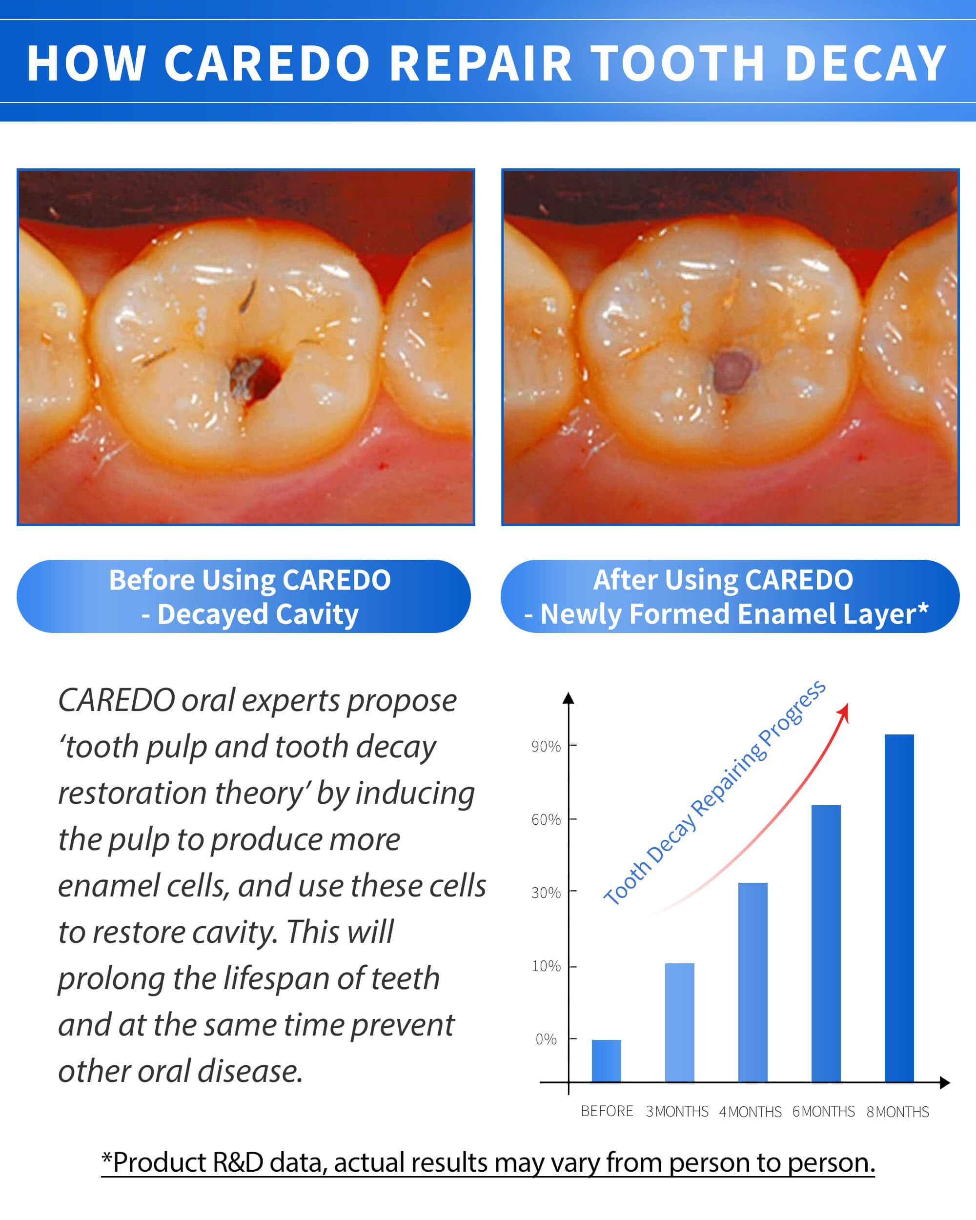 CAREDO Cavity Repair Toothpaste Set – 100g Hydroxyapatite + 16g Pulpitis Ointment