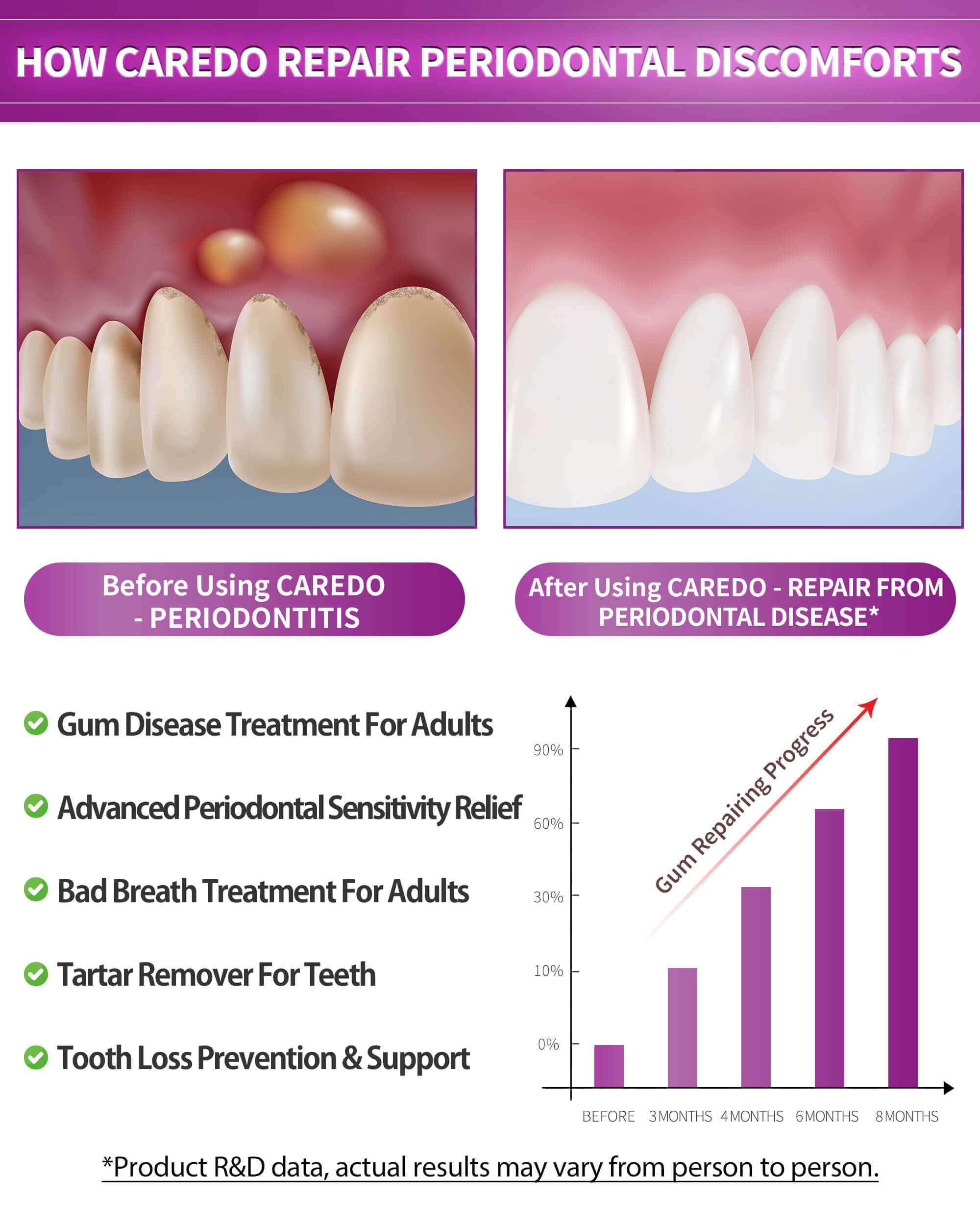 CAREDO Gum Repair Toothpaste - Fluoride Free Periodontal Treatment
