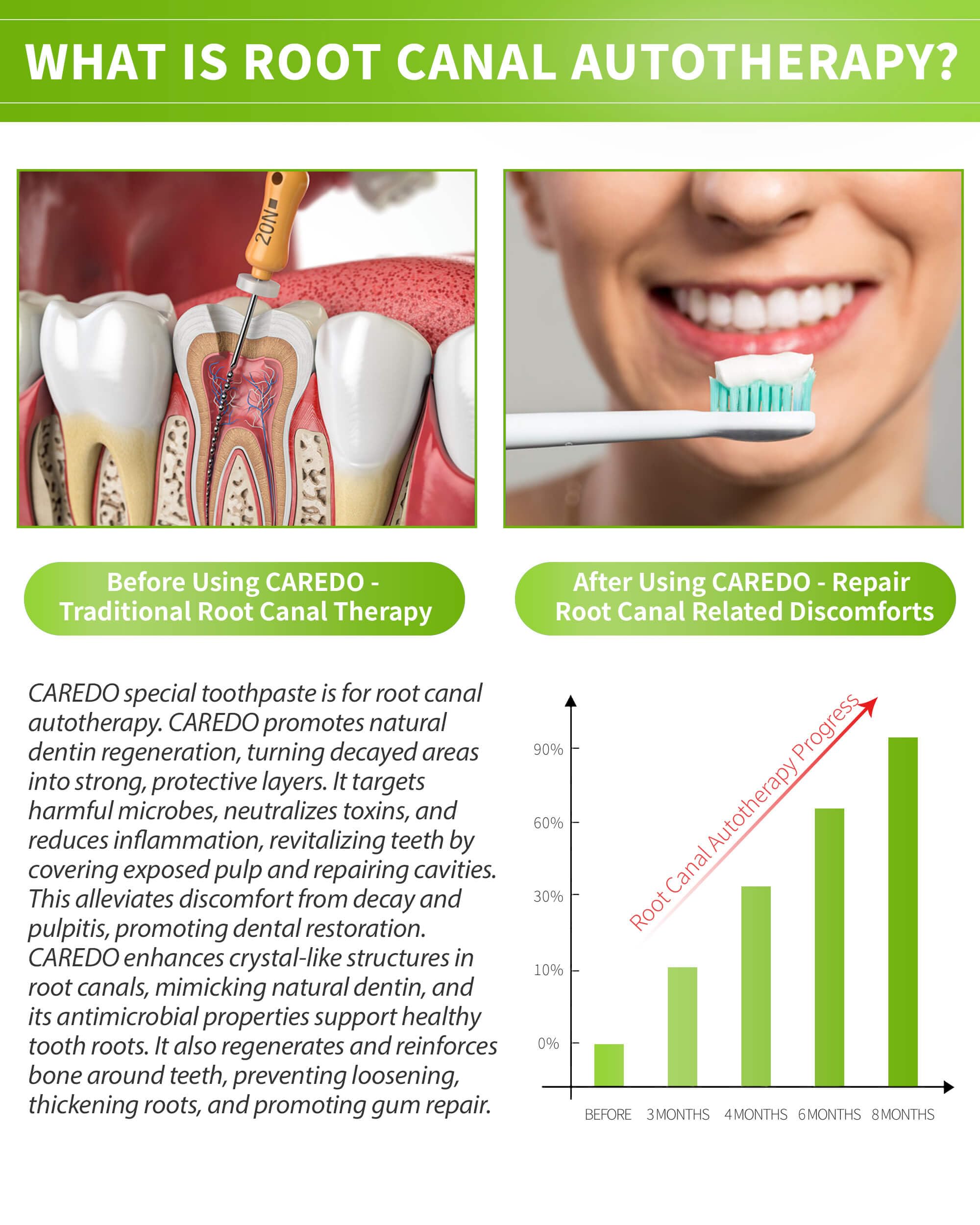 CAREDO Toothpaste Gum Repair for Root Canal Autotherapy - Mint 3.5 Oz x 2 Tubes
