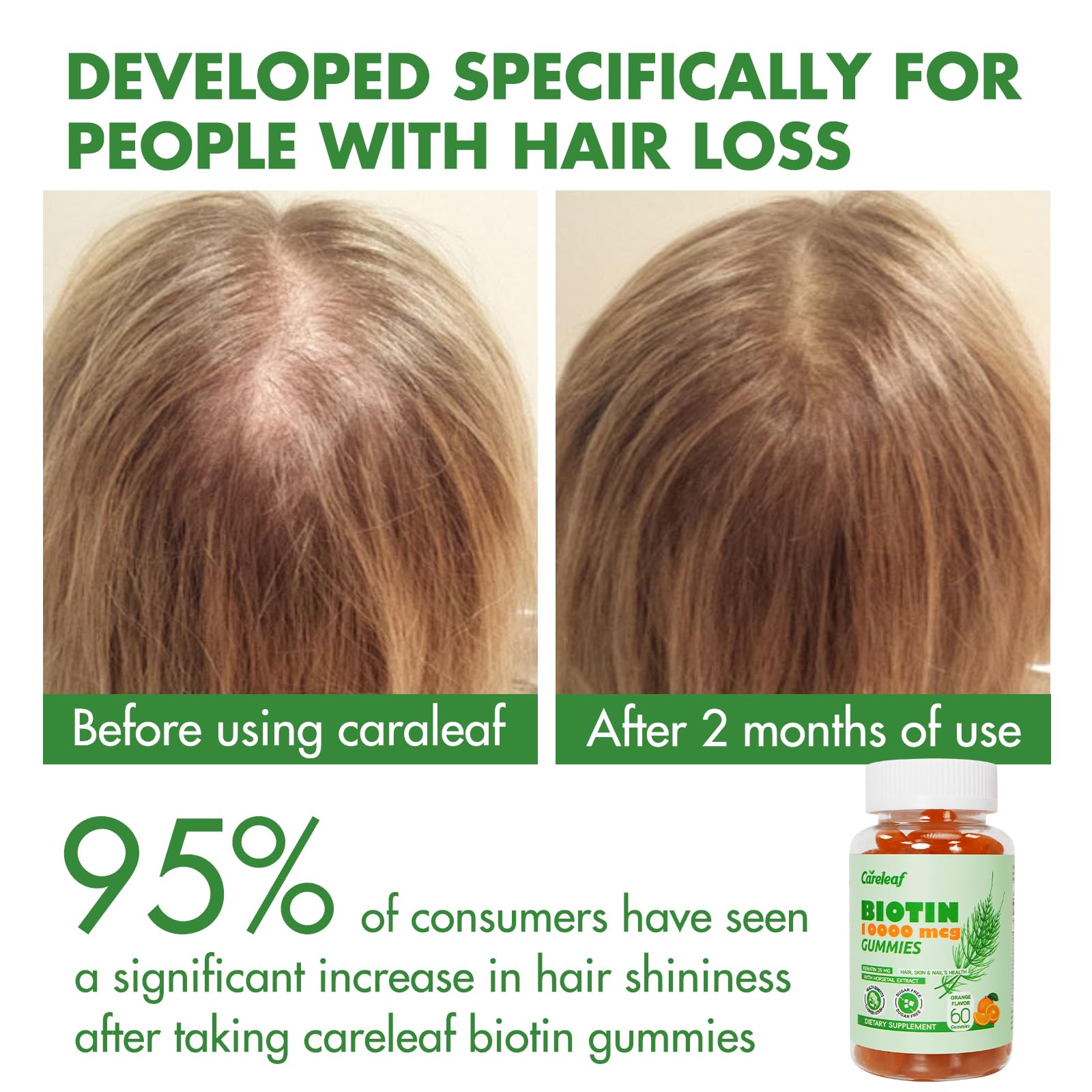 Careleaf Biotin Gummies – 10000 mcg Biotin for Hair Growth, Nails & Skin | 60 Count, Orange