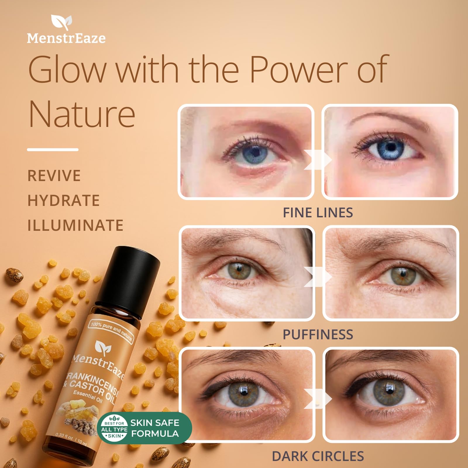 Castor Oil Roll-On with Frankincense for Eyes – 10ml