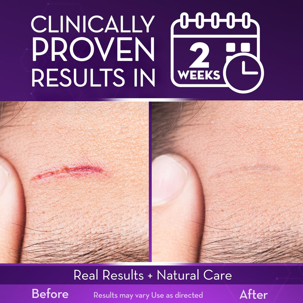 Cicatricure Advanced Scar Gel for Face & Body - Visible Results in 2 Weeks | Scar Treatment for Surgical, Acne, Burns, Stretch Marks | Pack of 2