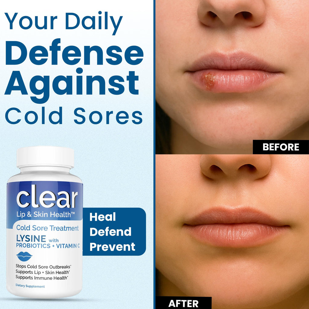 Clear Probiotics Lysine Cold Sore Treatment for Lips – Probiotic Lysine + Vitamin C – 180 Capsules