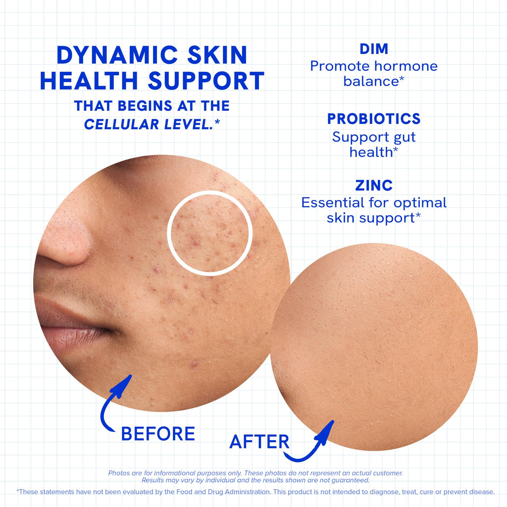 Clear Skin Supplement with Zinc, DIM & Probiotics | 60 Count