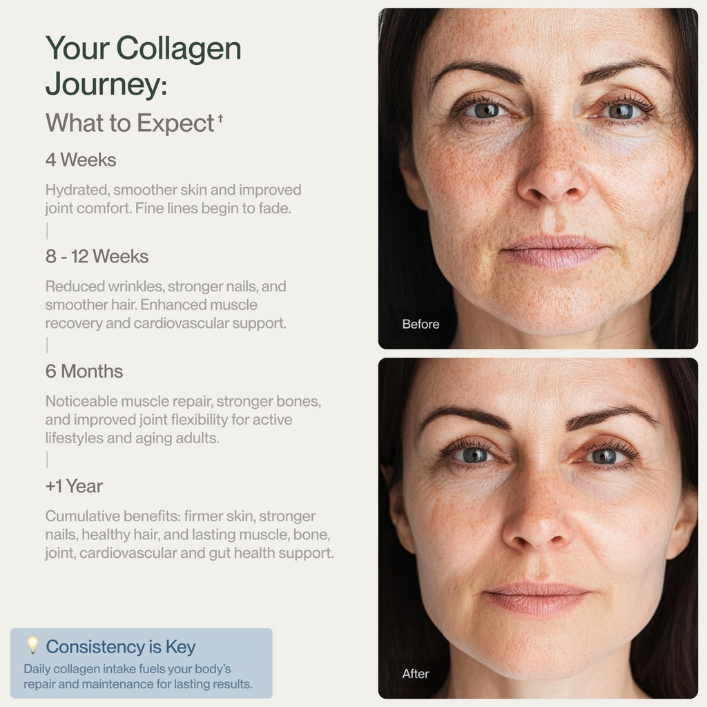 Colla Vita Grass-Fed Collagen Peptides Powder – Type I & III, Unflavored, 16 oz (45 Servings) – Hair, Skin, Nails & Joints