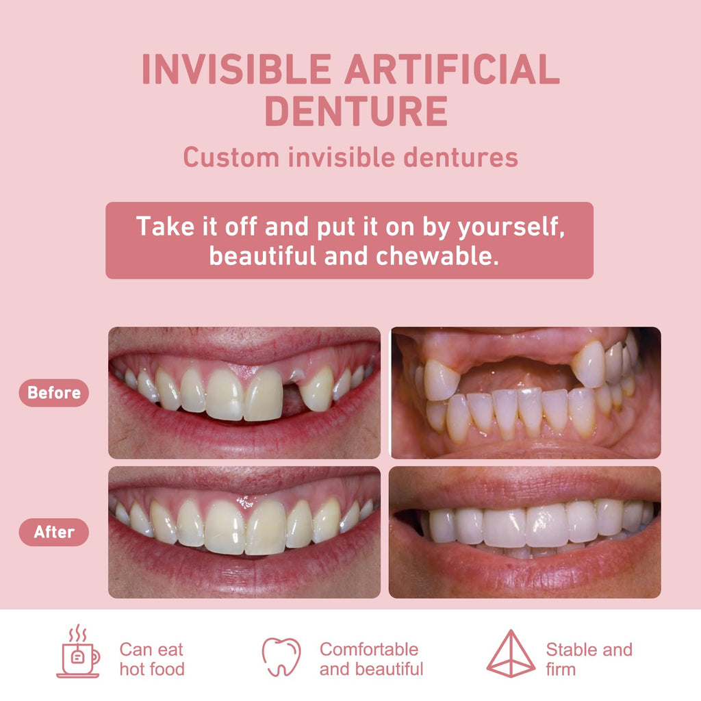 Custom Partial Dentures – Removable Denture Set for Missing Teeth (1-6) with Case | Natural Look & Comfortable Fit