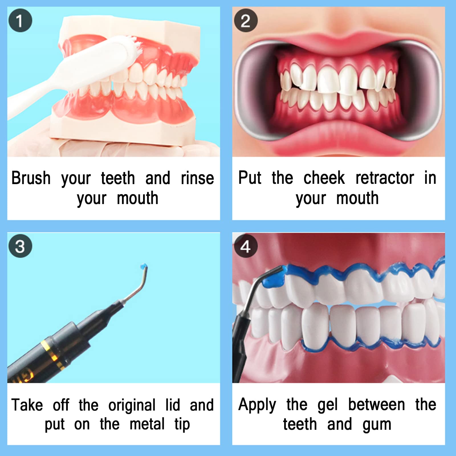 Dental Gingival Barrier Protection Gel – 10Pcs, 3ML Gum Protector for Teeth Whitening