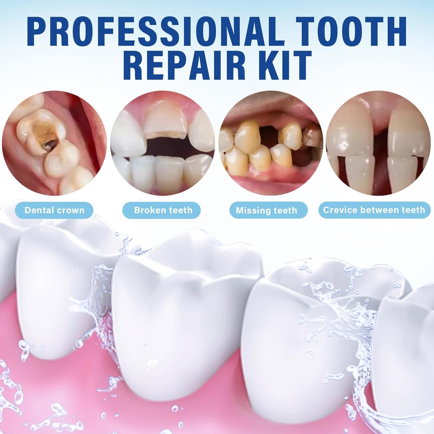 Dental Restoration Kit: Zinc Oxide Eugenol Cement for Temporary Crowns & Bridges