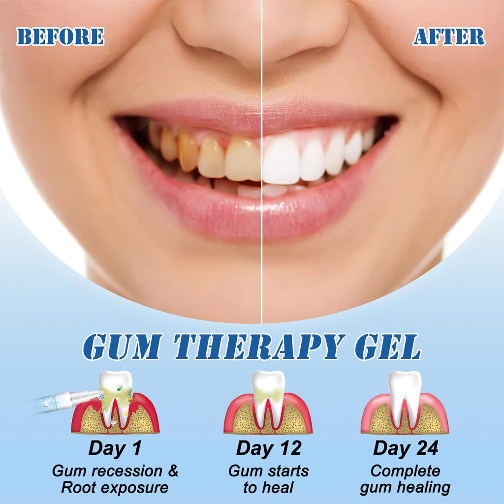Neslemy Gum Shield Therapy Gel – Gum Therapy Gel, Teeth Whitening Essence Pen (Pack of 3)
