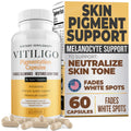 Dermawonder Vitiligo Capsules (60 Count) – Improve Skin Pigmentation & Reduce White Spots