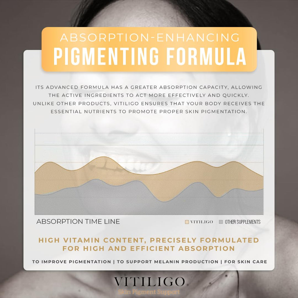 Dermawonder Vitiligo Capsules 60 Count - Support Pigmentation & Reduce White Spots