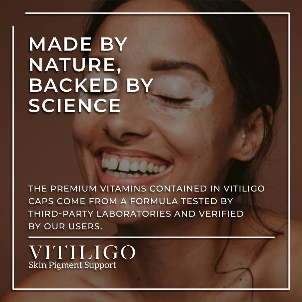 Dermawonder Vitiligo Capsules 60 Count | Effective Pigmentation Support & White Spot Reduction