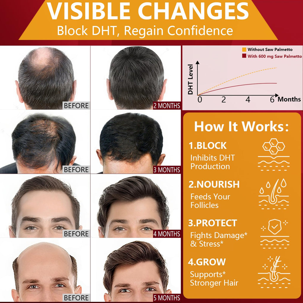 DHT Blocker for Men | Extra Strength Saw Palmetto & Biotin Hair Growth