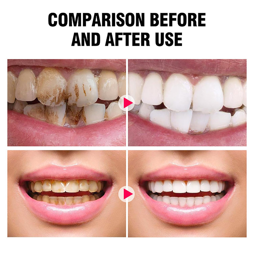 DISAAR BEAUTY Smokers Tooth Powder – Remove Tobacco Stains & Whitens Teeth (50g)